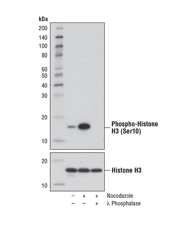 Phospho-Histone H3 (Ser10) (D7N8E) XP<sup>®</sup> Rabbit mAb #53348